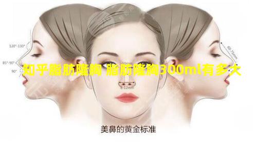 知乎脂肪隆胸 脂肪隆胸300ml有多大